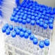 Над 1000 жени се изследваха за HPV - 